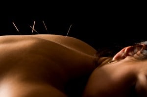 Indigo Massage and Wellness - Acupuncture St Louis